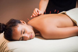 طب سوزنی (Acupuncture)